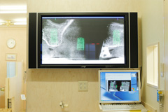 正確で精密な診査診断に　「歯科用CT」 (2)